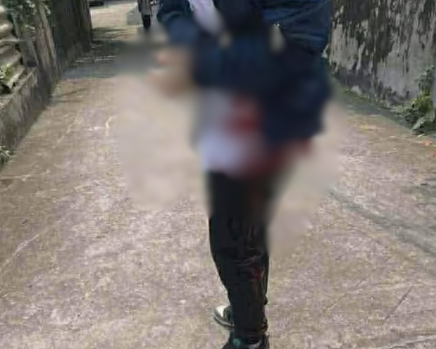 VI:DEO 0CHE: Cân nhắc trước khi xem